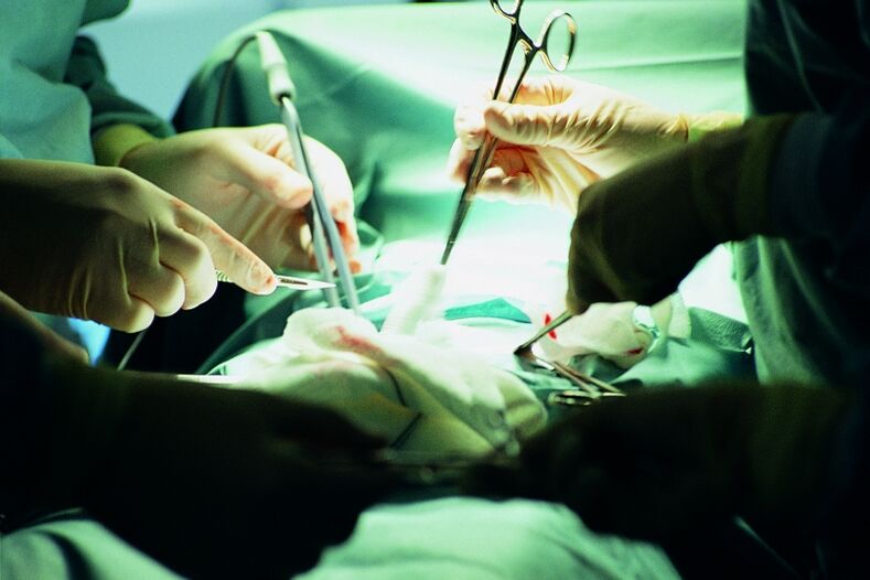 surgically increasing the thickness of the penis